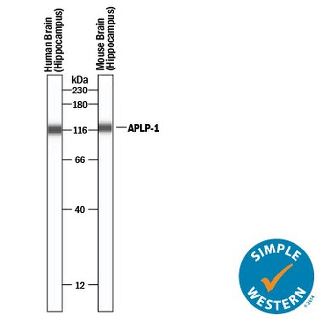 APLP1 Antibody in Western Blot (WB)