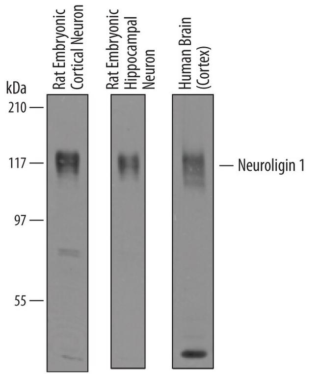 Neuroligin 1 Antibody in Western Blot (WB)