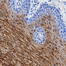 TGM3 Antibody in Immunohistochemistry (Paraffin) (IHC (P))