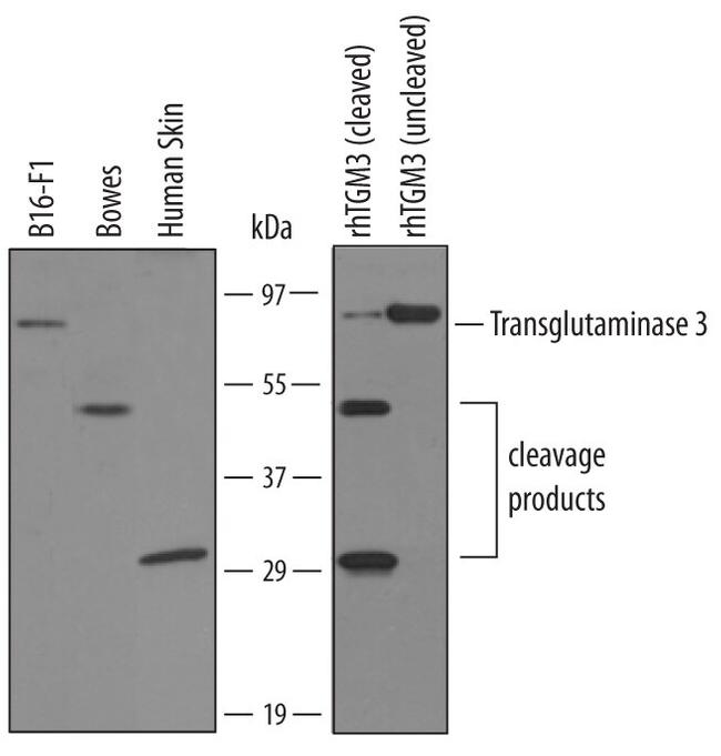 TGM3 Antibody in Western Blot (WB)