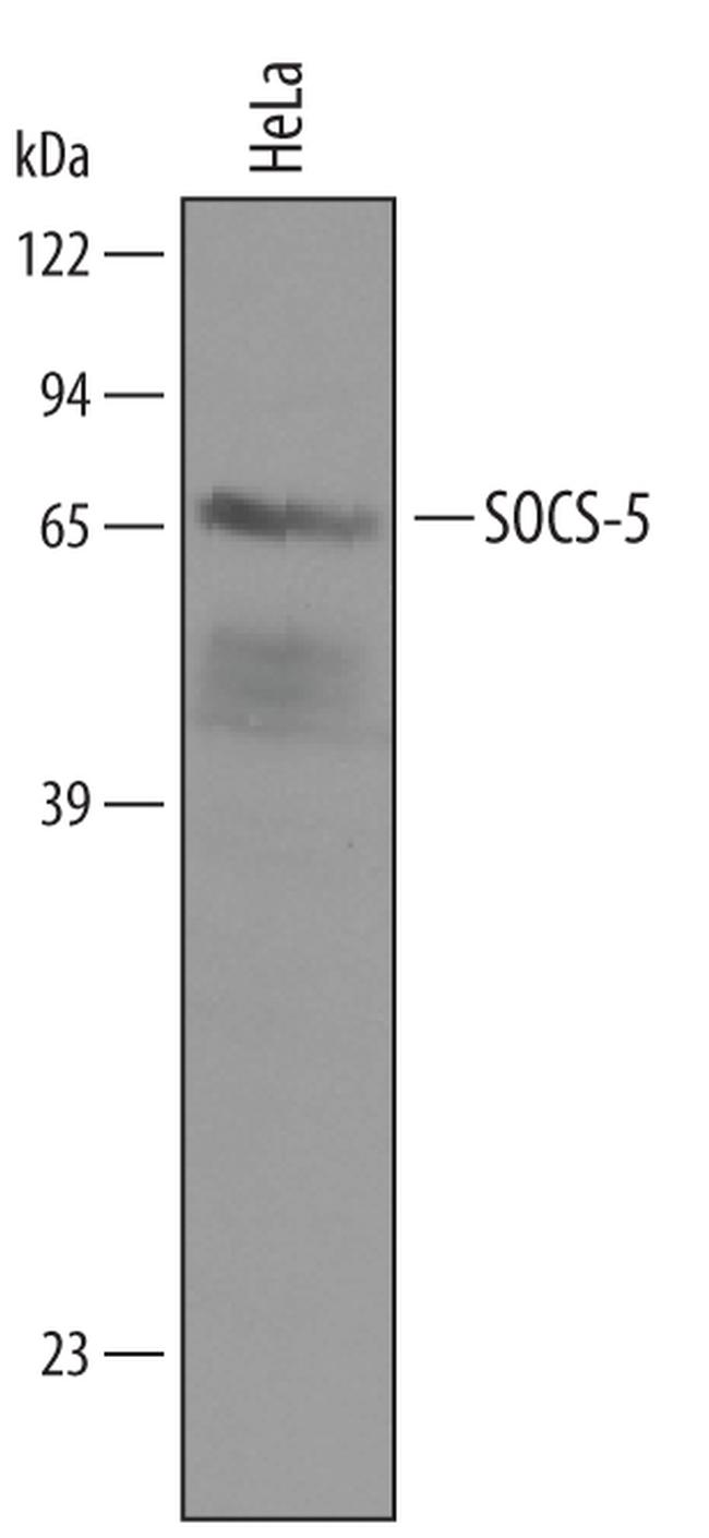 SOCS5 Antibody in Western Blot (WB)