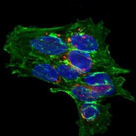 CPLX2 Antibody in Immunocytochemistry (ICC/IF)