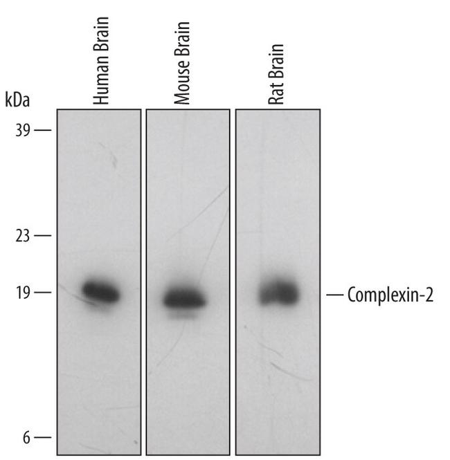 CPLX2 Antibody in Western Blot (WB)