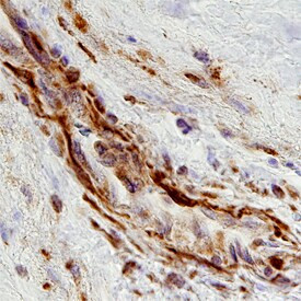 ADAMTS15 Antibody in Immunohistochemistry (Paraffin) (IHC (P))