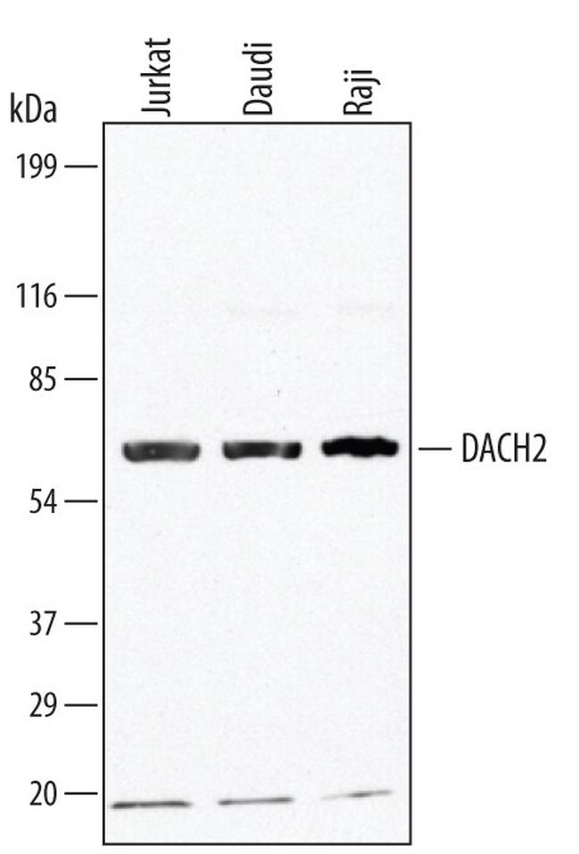 DACH2 Antibody in Western Blot (WB)