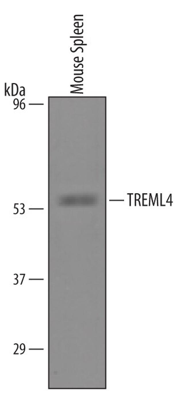 HBEGF Antibody in Western Blot (WB)