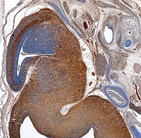 DIXDC1 Antibody in Immunohistochemistry (Frozen) (IHC (F))