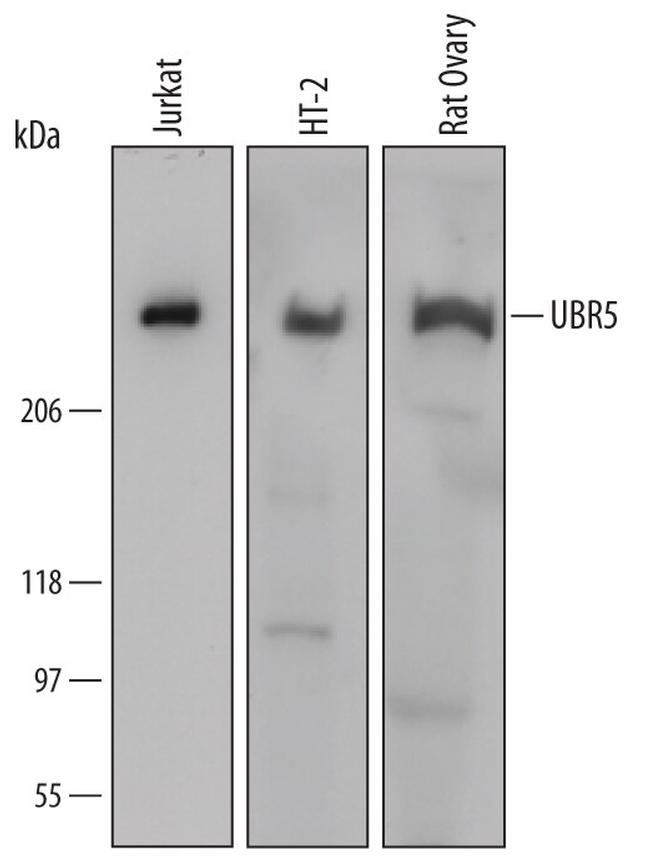 HYD Antibody in Western Blot (WB)