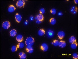 AIF Antibody in Immunocytochemistry (ICC/IF)