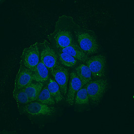 AIF Antibody in Immunocytochemistry (ICC/IF)