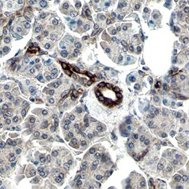 Phospho-MSK2 (Ser196) Antibody in Immunohistochemistry (Paraffin) (IHC (P))