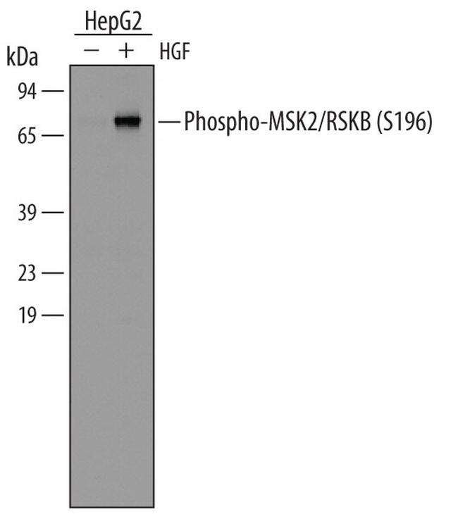 Phospho-MSK2 (Ser196) Antibody in Western Blot (WB)