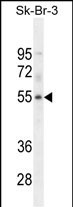 WDR21B Antibody in Western Blot (WB)