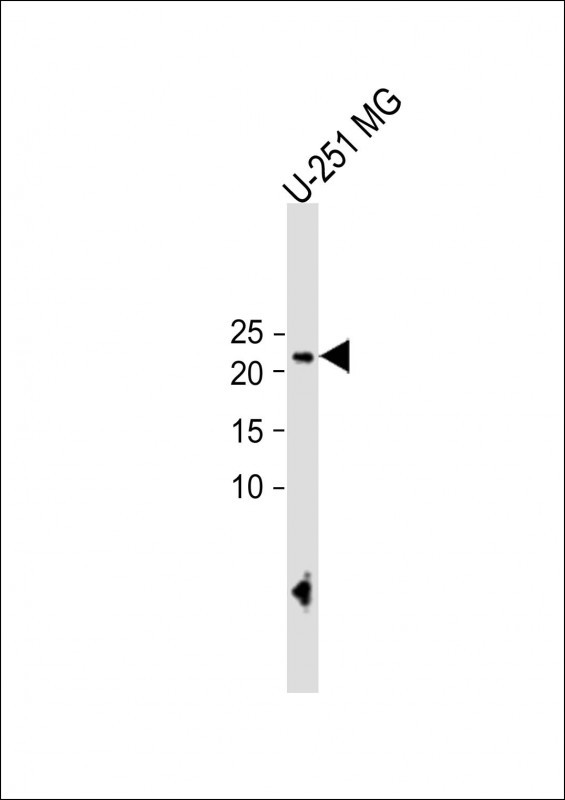 ECAT1 Antibody in Western Blot (WB)