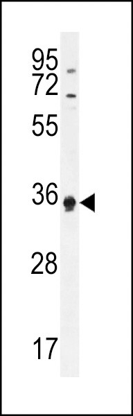 ECAT1 Antibody in Western Blot (WB)