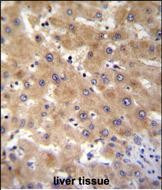 GAGE12B Antibody in Immunohistochemistry (Paraffin) (IHC (P))