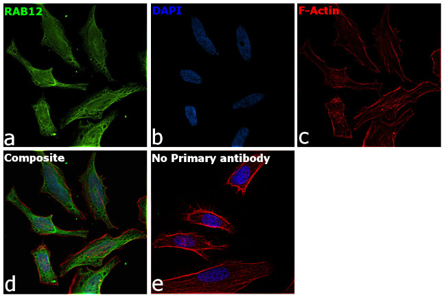 RAB12 Antibody in Immunocytochemistry (ICC/IF)