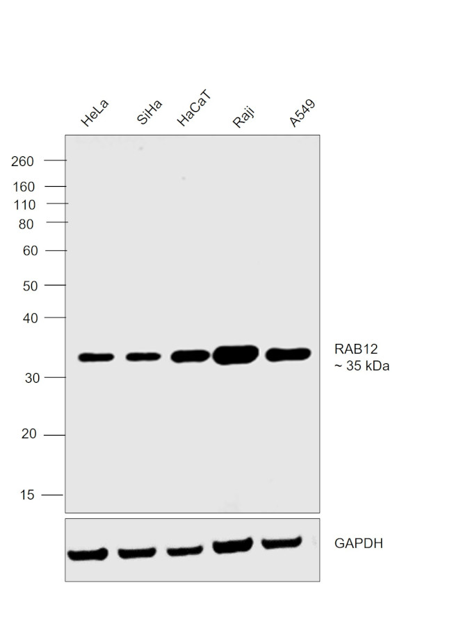 RAB12 Antibody in Western Blot (WB)