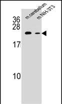 RAB12 Antibody in Western Blot (WB)