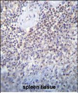 PATL2 Antibody in Immunohistochemistry (Paraffin) (IHC (P))