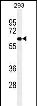 PATL2 Antibody in Western Blot (WB)