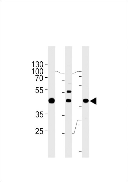 GTF2H2C Antibody in Western Blot (WB)