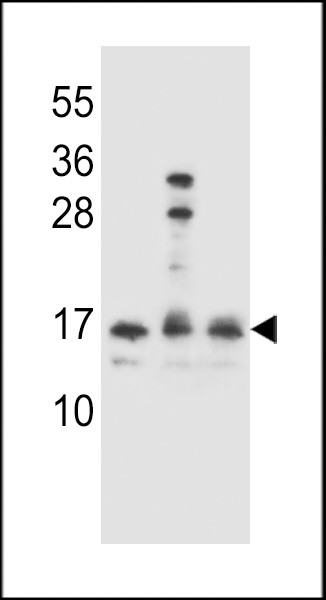 HOPX Antibody in Western Blot (WB)