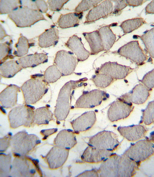 DDX60L Antibody in Immunohistochemistry (Paraffin) (IHC (P))