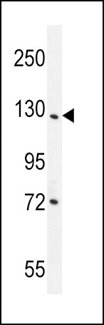 DDX60L Antibody in Western Blot (WB)