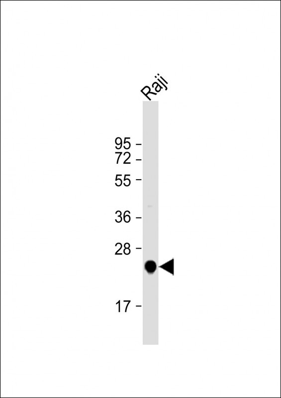 UQCRFS1 Antibody in Western Blot (WB)