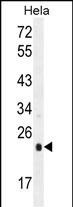 UQCRFS1 Antibody in Western Blot (WB)