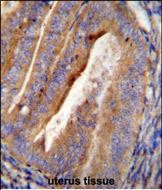 Mimecan Antibody in Immunohistochemistry (Paraffin) (IHC (P))