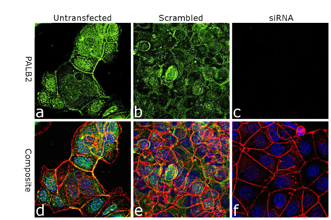 PALB2 Antibody in Immunocytochemistry (ICC/IF)