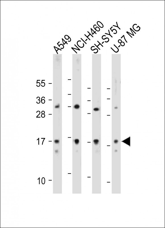 TMEM100 Antibody in Western Blot (WB)