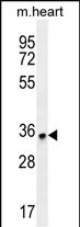 ZNF524 Antibody in Western Blot (WB)