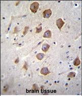 KCNRG Antibody in Immunohistochemistry (Paraffin) (IHC (P))