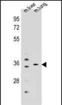 KCNRG Antibody in Western Blot (WB)