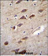 RUSC2 Antibody in Immunohistochemistry (Paraffin) (IHC (P))