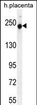 RUSC2 Antibody in Western Blot (WB)