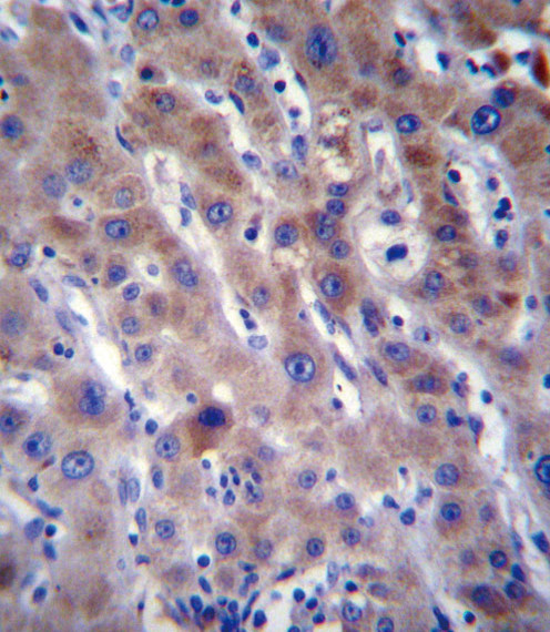 FADS2 Antibody in Immunohistochemistry (Paraffin) (IHC (P))