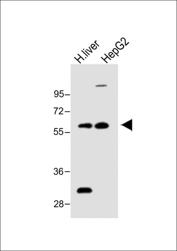 FADS2 Antibody in Western Blot (WB)