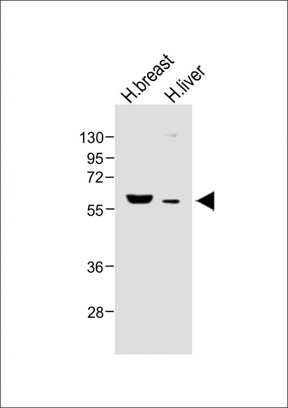 FADS2 Antibody in Western Blot (WB)