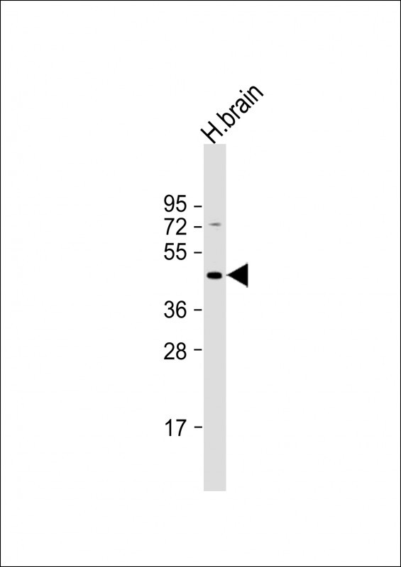 GABRR3 Antibody in Western Blot (WB)