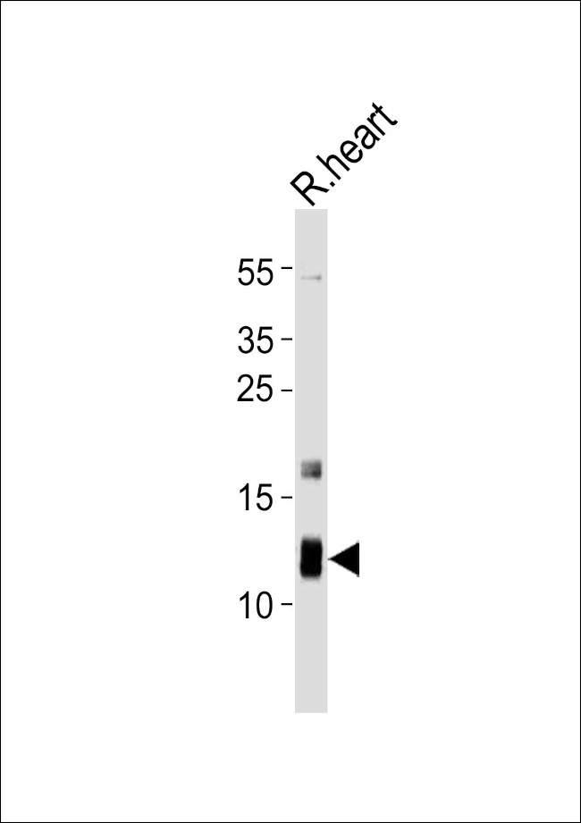 ATP5J Antibody in Western Blot (WB)