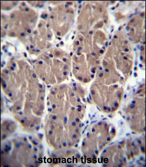 POLR1B Antibody in Immunohistochemistry (Paraffin) (IHC (P))