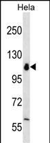 POLR1B Antibody in Western Blot (WB)