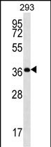 OR10H5 Antibody in Western Blot (WB)