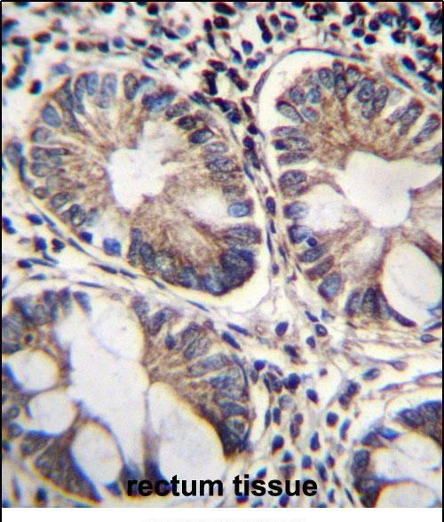 ME2 Antibody in Immunohistochemistry (Paraffin) (IHC (P))