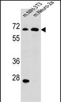 ME2 Antibody in Western Blot (WB)