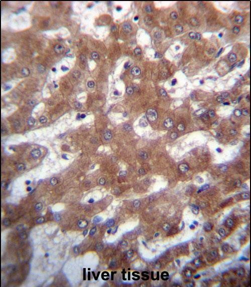 TRUB1 Antibody in Immunohistochemistry (Paraffin) (IHC (P))